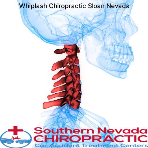 Finding a Qualified Whiplash Chiropractor in Nevada Sloan - Whiplash Chiropractor Sloan